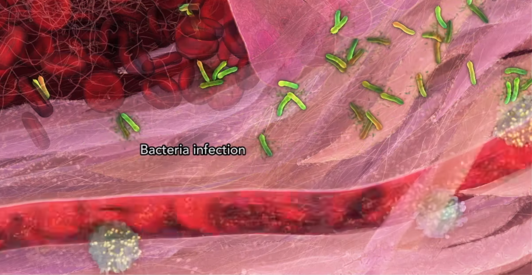 细菌进入血液循环示意图